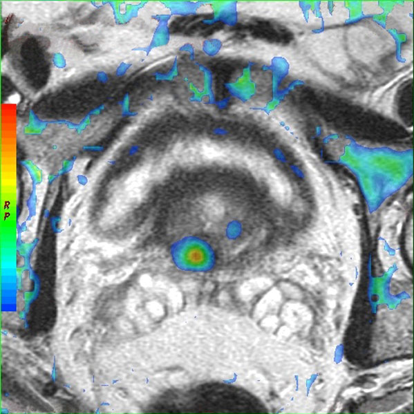 Scientific spotlights from the ISMH